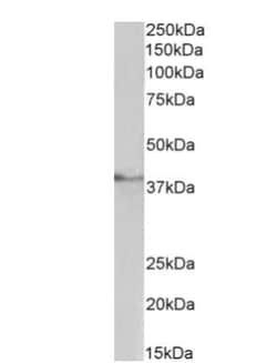 TATA binding protein TBP Antibody, Novus Biologicals 0.1 mg | Buy Online | Novus Biologicals | Fisher Scientific