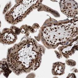 TAX1BP1 Antibody, Novus Biologicals 0.1mL; Unlabeled:Antibodies, Polyclonal