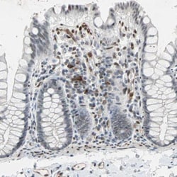 TAZ/WWTR1 Antibody, Novus Biologicals 0.1mL; Unlabeled:Antibodies, Polyclonal