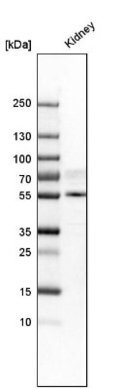TAZ/WWTR1 Antibody, Novus Biologicals 0.1mL; Unlabeled:Antibodies, Polyclonal