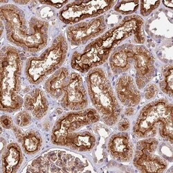 TBC1D1 Antibody, Novus Biologicals 25 &mu;L; Unlabeled:Antibodies, Polyclonal