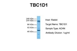 TBC1D1 Antibody, Novus Biologicals 0.05mg; Unlabeled:Antibodies, Polyclonal