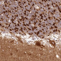 TBC1D14 Antibody, Novus Biologicals:Antibodies:Primary Antibodies