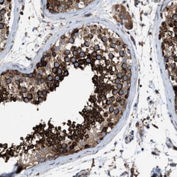TBC1D15 Antibody, Novus Biologicals:Antibodies:Primary Antibodies