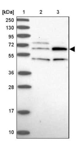 TBC1D19 Antibody, Novus Biologicals:Antibodies:Primary Antibodies