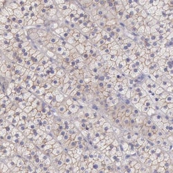 TBC1D22A Antibody, Novus Biologicals 0.1mL; Unlabeled:Antibodies, Polyclonal