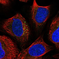 TBC1D23 Antibody, Novus Biologicals:Antibodies:Primary Antibodies