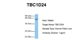 TBC1D24 Antibody, Novus Biologicals 100 &mu;L | Buy Online | Novus Biologicals | Fisher Scientific