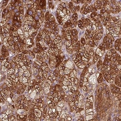 TBC1D4 Antibody, Novus Biologicals 0.1mL; Unlabeled:Antibodies, Polyclonal