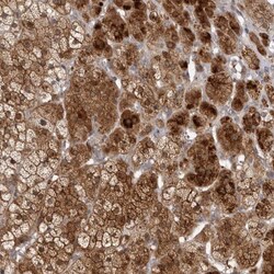 TBC1D8B Antibody, Novus Biologicals 0.1mL; Unlabeled:Antibodies, Polyclonal