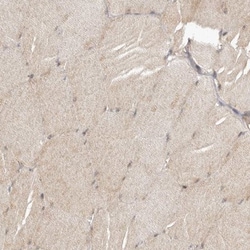 TBC1D8B Antibody, Novus Biologicals 0.1mL; Unlabeled:Antibodies, Polyclonal