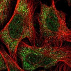 TBC1D9 Antibody, Novus Biologicals:Antibodies:Primary Antibodies