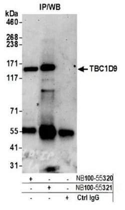 TBC1D9 Antibody, Novus Biologicals 0.1mg; Unlabeled:Antibodies, Polyclonal