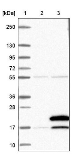 TBCA Antibody, Novus Biologicals 25 &mu;L | Buy Online | Novus Biologicals | Fisher Scientific