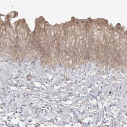TBCC Antibody, Novus Biologicals 25 &mu;L, Unlabeled:Antibodies, Polyclonal