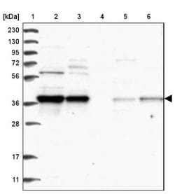 TBCC Antibody, Novus Biologicals 25 &mu;L, Unlabeled:Antibodies, Polyclonal