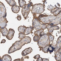 TBCE Antibody, Novus Biologicals 25 &mu;L; Unlabeled:Antibodies, Polyclonal