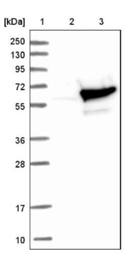 TBCE Antibody, Novus Biologicals 25 &mu;L; Unlabeled:Antibodies, Polyclonal