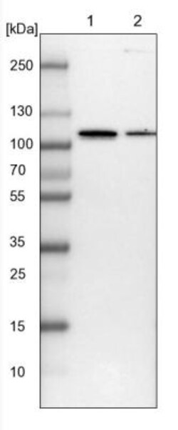 TBCK Antibody, Novus Biologicals 0.1mL; Unlabeled:Antibodies, Polyclonal