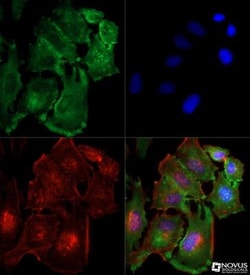 TBK1 Antibody (108A429) - BSA Free, Novus Biologicals:Antibodies:Primary