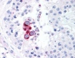TBK1 Antibody (108A429) - BSA Free, Novus Biologicals:Antibodies:Primary