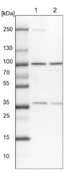 TBL3 Antibody, Novus Biologicals 0.1 mL | Buy Online | Novus Biologicals | Fisher Scientific