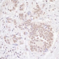 TBLR1 Antibody, Novus Biologicals 0.1mL; Unlabeled:Antibodies, Polyclonal
