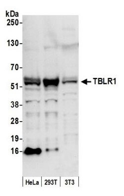 TBLR1 Antibody, Novus Biologicals 0.1mL; Unlabeled:Antibodies, Polyclonal