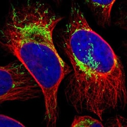 TBRG4 Antibody, Novus Biologicals:Antibodies:Primary Antibodies