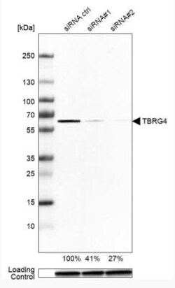 TBRG4 Antibody, Novus Biologicals:Antibodies:Primary Antibodies