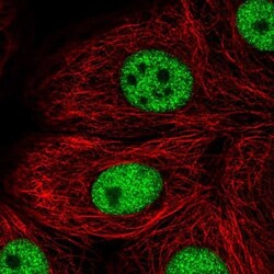 TBX2 Antibody, Novus Biologicals 0.1mL; Unlabeled:Antibodies, Polyclonal