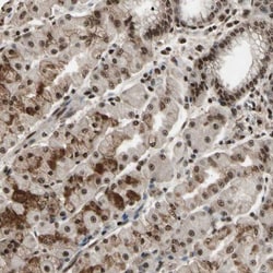 TBX2 Antibody, Novus Biologicals 0.1mL; Unlabeled:Antibodies, Polyclonal