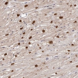 TBX5 Antibody, Novus Biologicals 25 μL; Unlabeled:Antibodies, Polyclonal