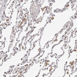 TBX5 Antibody, Novus Biologicals 25 μL; Unlabeled:Antibodies, Polyclonal