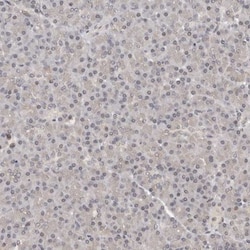 TBX5 Antibody, Novus Biologicals 25 μL; Unlabeled:Antibodies, Polyclonal