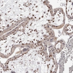 TBX5 Antibody, Novus Biologicals 25 μL; Unlabeled:Antibodies, Polyclonal
