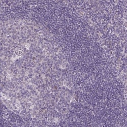 TCEAL7 Antibody, Novus Biologicals 25 &mu;L | Buy Online | Novus Biologicals | Fisher Scientific