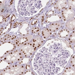 TCF-2/HNF-1 beta Antibody (CL0374), Novus Biologicals:Antibodies:Primary