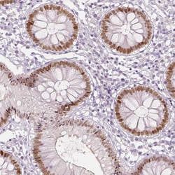 TCF-2/HNF-1 beta Antibody (CL0374), Novus Biologicals:Antibodies:Primary
