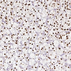 TCF-2/HNF-1 beta Antibody (CL0374), Novus Biologicals:Antibodies:Primary