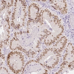 TCF-2/HNF-1 beta Antibody (CL0374), Novus Biologicals:Antibodies:Primary