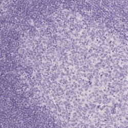 TCF-2/HNF-1 beta Antibody (CL0374), Novus Biologicals:Antibodies:Primary