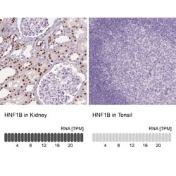 TCF-2/HNF-1 beta Antibody (CL0374), Novus Biologicals:Antibodies:Primary