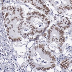 TCF-2/HNF-1 beta Antibody, Novus Biologicals:Antibodies:Primary Antibodies