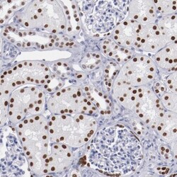 TCF-2/HNF-1 beta Antibody, Novus Biologicals:Antibodies:Primary Antibodies