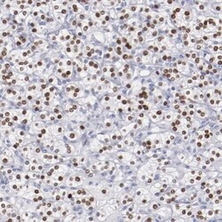 TCF-2/HNF-1 beta Antibody, Novus Biologicals:Antibodies:Primary Antibodies