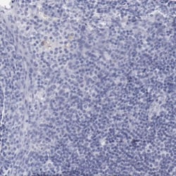 TCF-2/HNF-1 beta Antibody, Novus Biologicals:Antibodies:Primary Antibodies