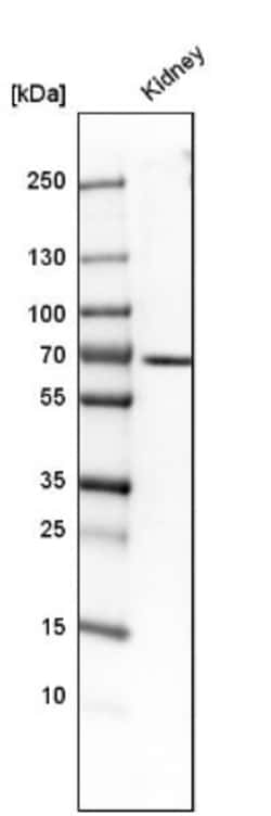 TCF-2/HNF-1 beta Antibody, Novus Biologicals:Antibodies:Primary Antibodies
