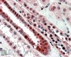 TCF-3/E2A Antibody, Novus Biologicals 0.1mg; Unlabeled:Antibodies, Polyclonal