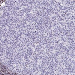TCF-3/E2A Antibody, Novus Biologicals:Antibodies:Primary Antibodies